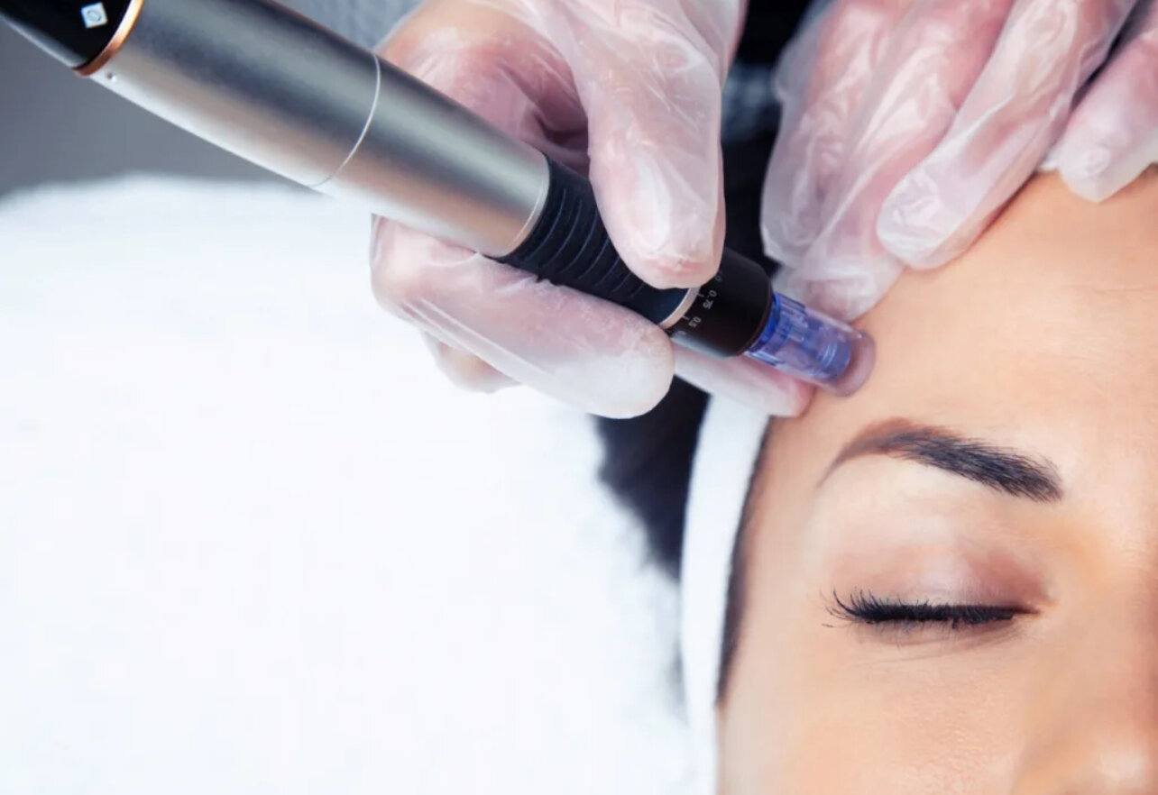 Glow from Within: Discover Skin Boosters at  Simply Radiant Aesthetics 